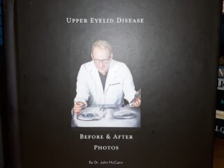 Upper Eyelid Disease: Before & After Photos ~ by Dr. John McCann